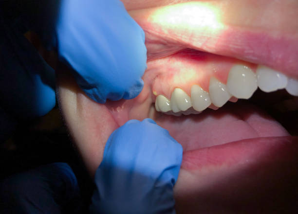 Best Emergency Dentist for Knocked-Out Tooth in Norridge, IL